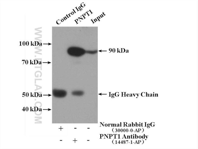 PNPT1 Antibody in Immunoprecipitation (IP)