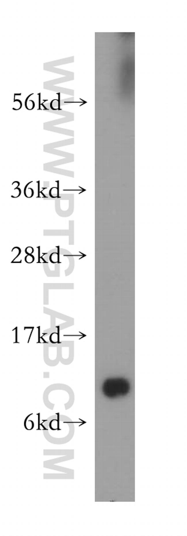 DBI Antibody in Western Blot (WB)