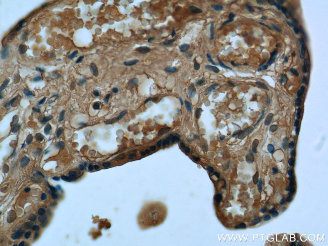 RPS7 Antibody in Immunohistochemistry (Paraffin) (IHC (P))