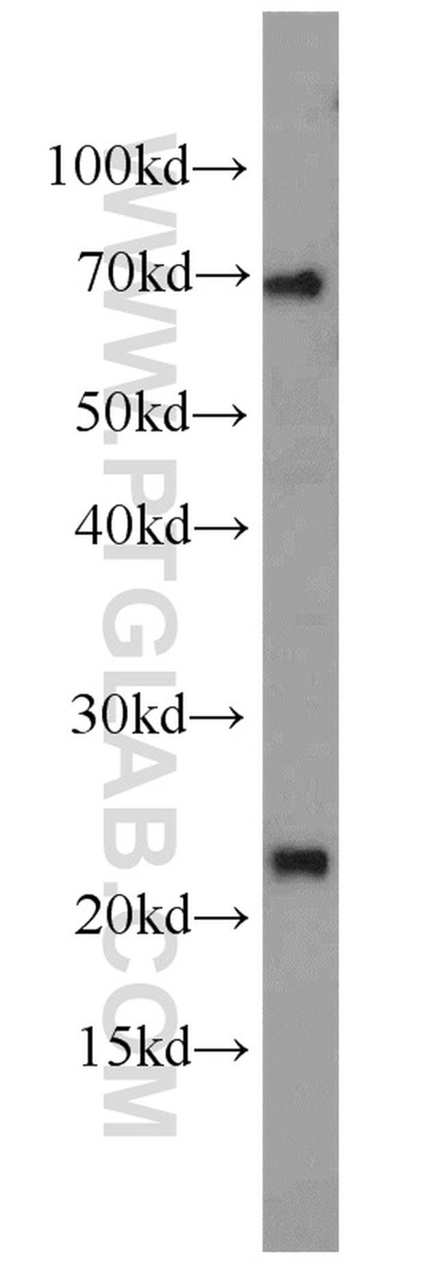 RPS7 Antibody in Western Blot (WB)