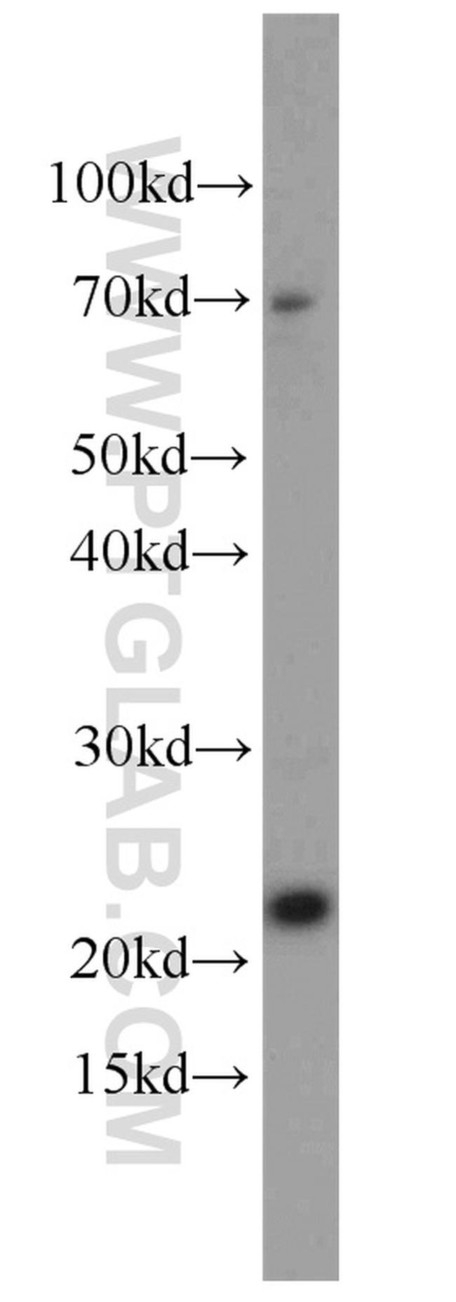 RPS7 Antibody in Western Blot (WB)