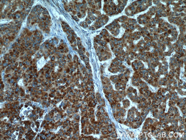 HBXIP Antibody in Immunohistochemistry (Paraffin) (IHC (P))