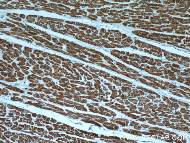 HBXIP Antibody in Immunohistochemistry (Paraffin) (IHC (P))