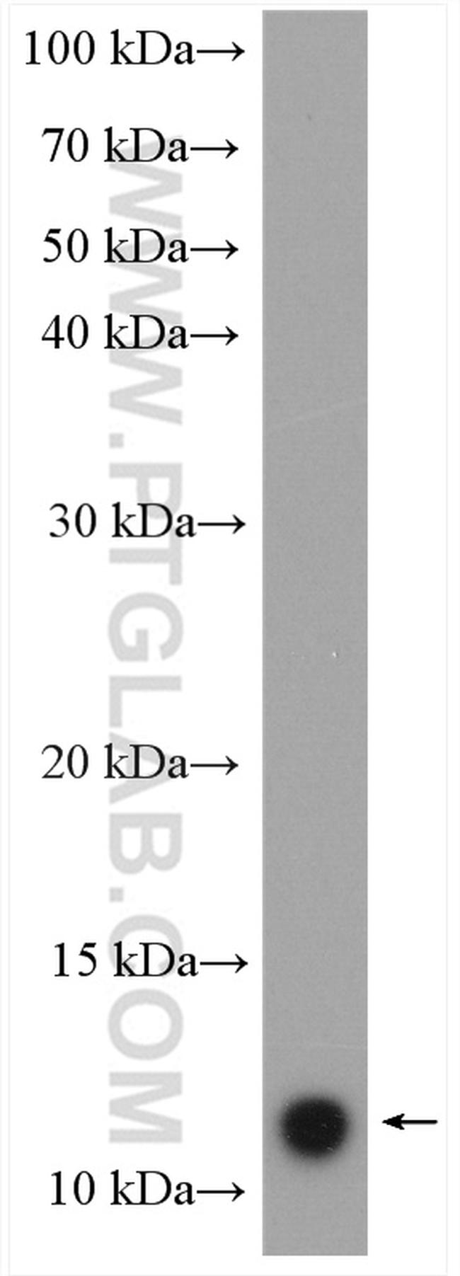 HBXIP Antibody in Western Blot (WB)