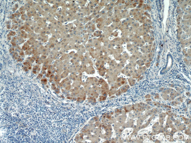 HBXIP Antibody in Immunohistochemistry (Paraffin) (IHC (P))