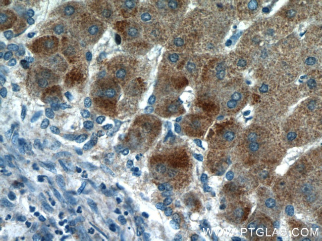 HBXIP Antibody in Immunohistochemistry (Paraffin) (IHC (P))