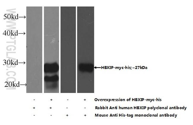 HBXIP Antibody in Western Blot (WB)