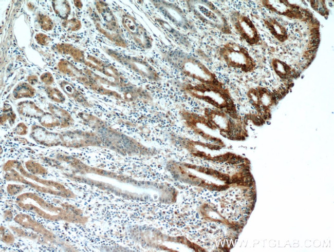 Gastrokine 1 Antibody in Immunohistochemistry (Paraffin) (IHC (P))