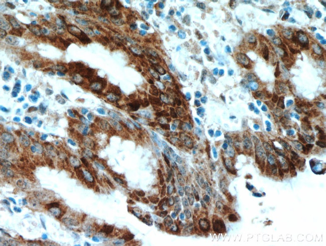 Gastrokine 1 Antibody in Immunohistochemistry (Paraffin) (IHC (P))