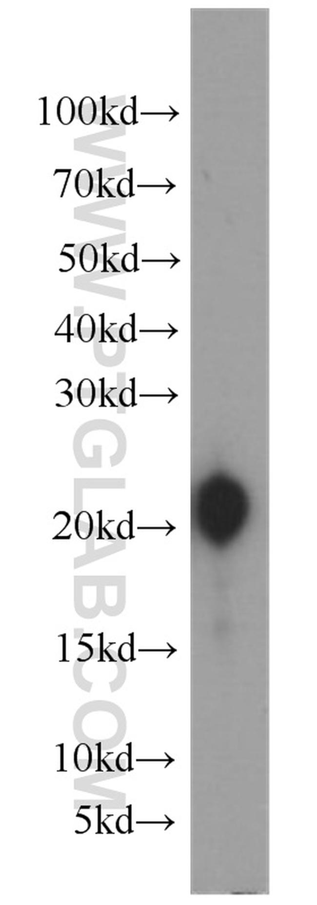 Gastrokine 1 Antibody in Western Blot (WB)