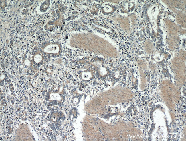 Gastrokine 1 Antibody in Immunohistochemistry (Paraffin) (IHC (P))