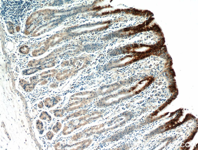 Gastrokine 1 Antibody in Immunohistochemistry (Paraffin) (IHC (P))