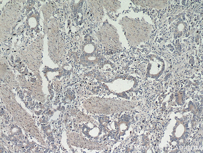 Gastrokine 1 Antibody in Immunohistochemistry (Paraffin) (IHC (P))