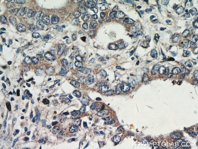 Gastrokine 1 Antibody in Immunohistochemistry (Paraffin) (IHC (P))