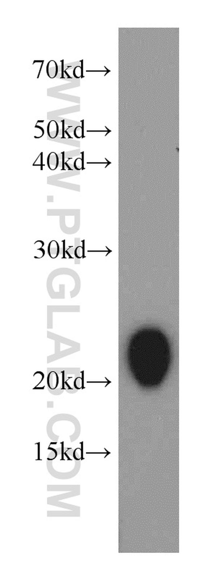 Gastrokine 1 Antibody in Western Blot (WB)