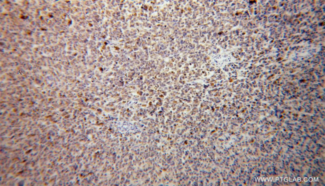 VTI1B Antibody in Immunohistochemistry (Paraffin) (IHC (P))