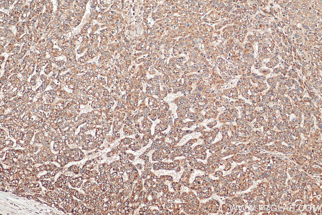 VTI1B Antibody in Immunohistochemistry (Paraffin) (IHC (P))