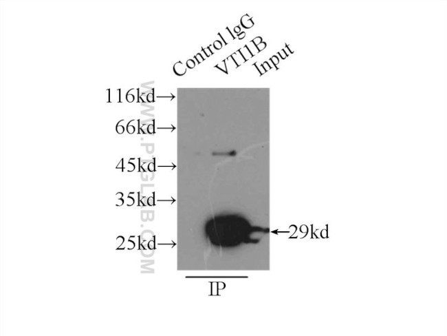 VTI1B Antibody in Immunoprecipitation (IP)