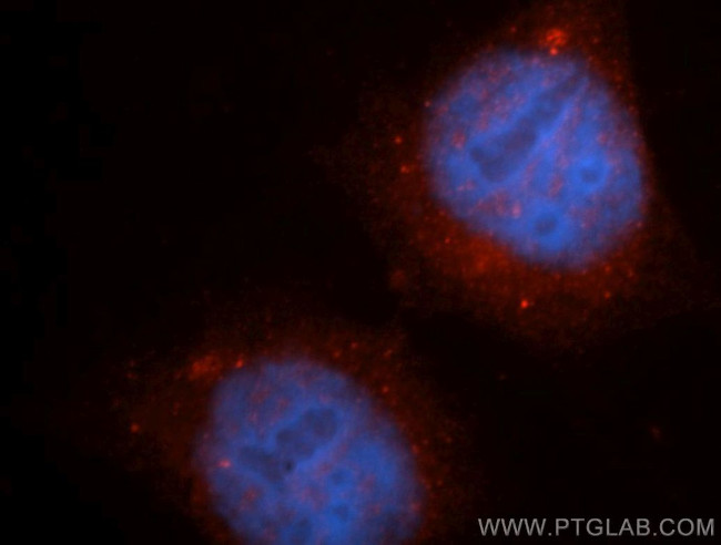 CEP250/CNAP1 Antibody in Immunocytochemistry (ICC/IF)