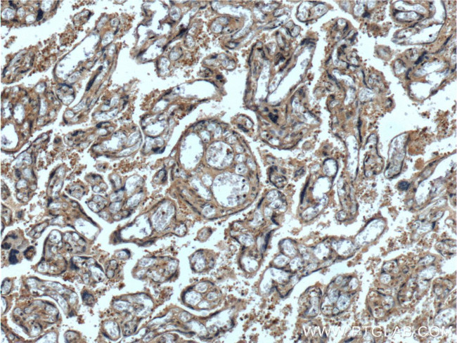 CEP250/CNAP1 Antibody in Immunohistochemistry (Paraffin) (IHC (P))