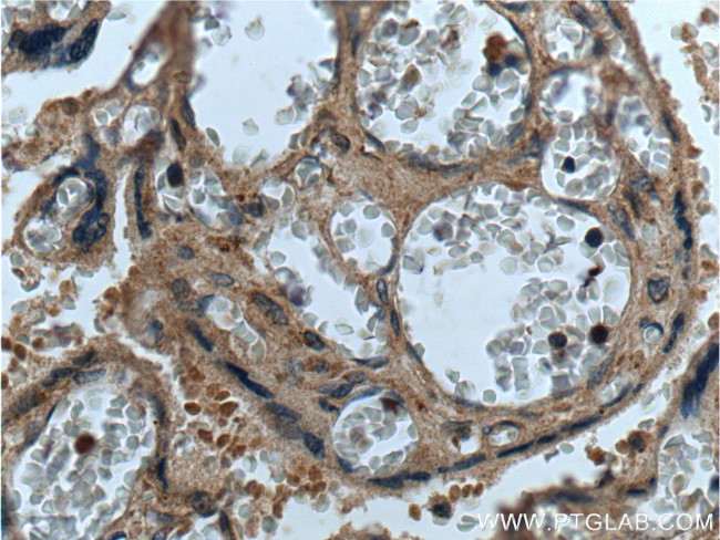 CEP250/CNAP1 Antibody in Immunohistochemistry (Paraffin) (IHC (P))