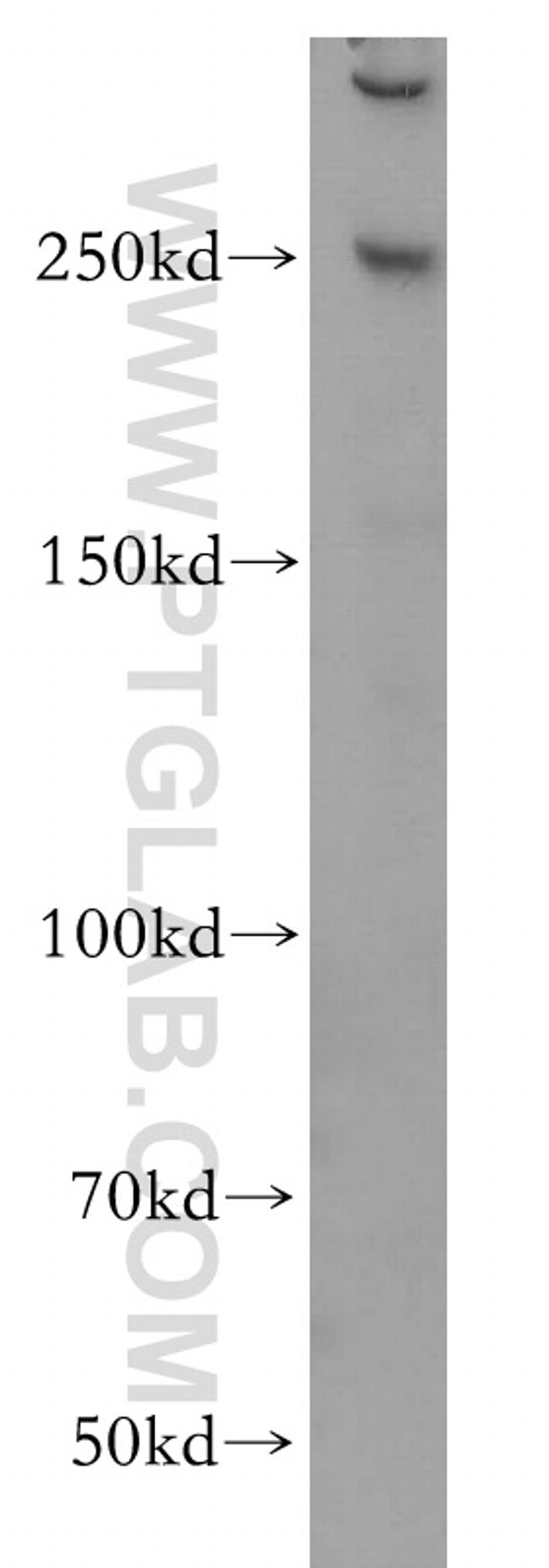 CEP250/CNAP1 Antibody in Western Blot (WB)