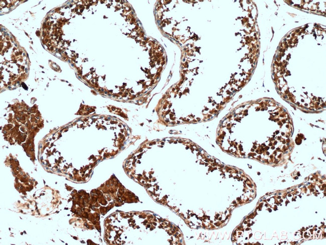 PRM2 Antibody in Immunohistochemistry (Paraffin) (IHC (P))