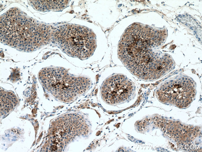 PRM2 Antibody in Immunohistochemistry (Paraffin) (IHC (P))