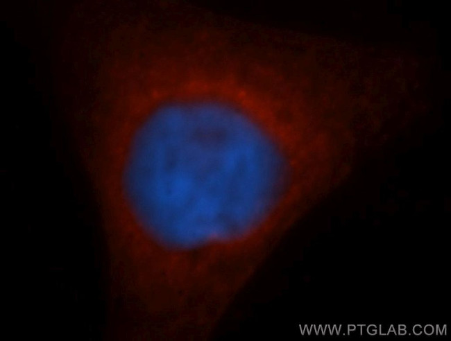 GSTM5 Antibody in Immunocytochemistry (ICC/IF)