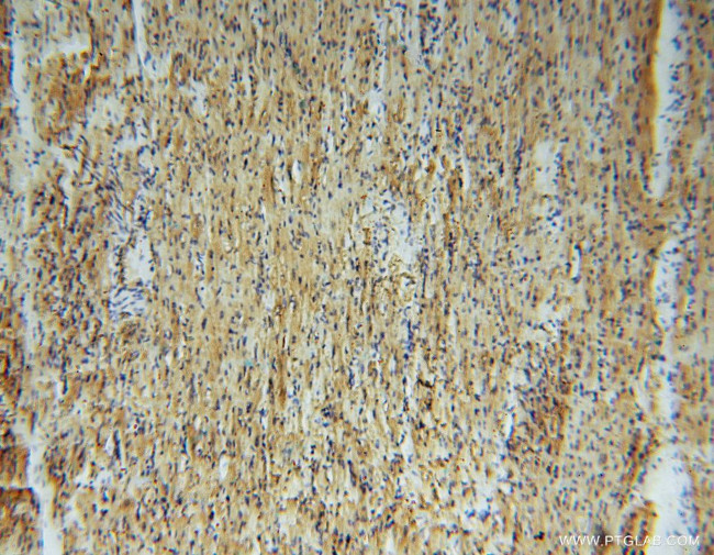 GSTM5 Antibody in Immunohistochemistry (Paraffin) (IHC (P))