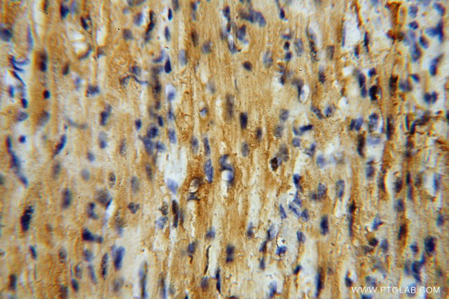 GSTM5 Antibody in Immunohistochemistry (Paraffin) (IHC (P))