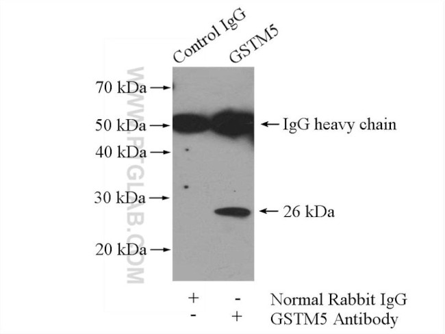 GSTM5 Antibody in Immunoprecipitation (IP)