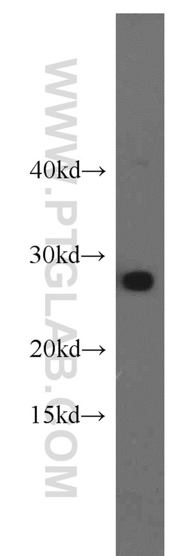 GSTM5 Antibody in Western Blot (WB)