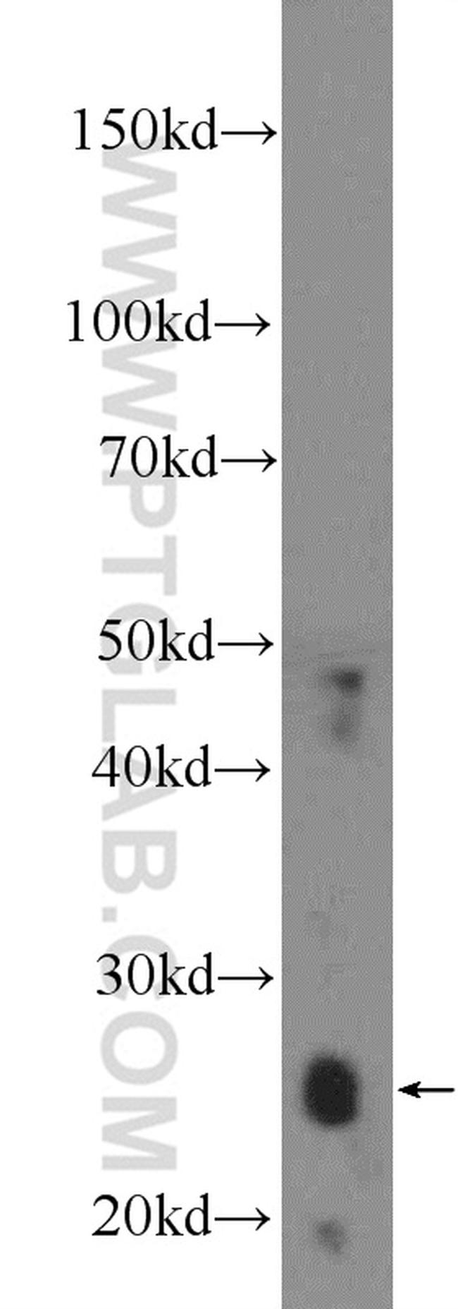 GSTM5 Antibody in Western Blot (WB)