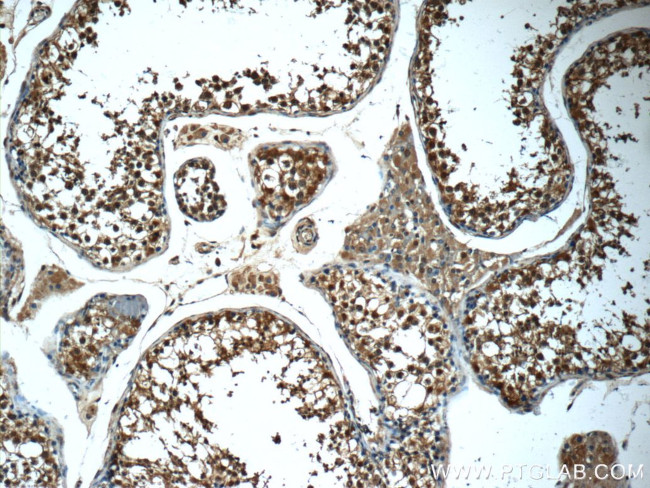 14-3-3 Antibody in Immunohistochemistry (Paraffin) (IHC (P))