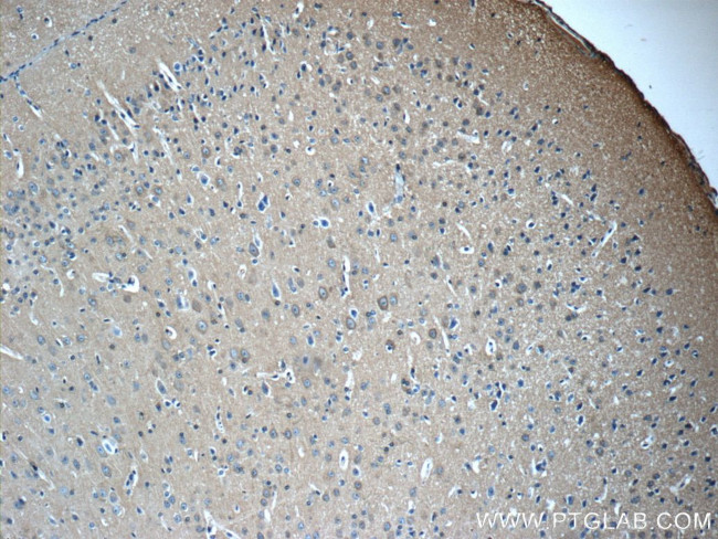 14-3-3 Antibody in Immunohistochemistry (Paraffin) (IHC (P))