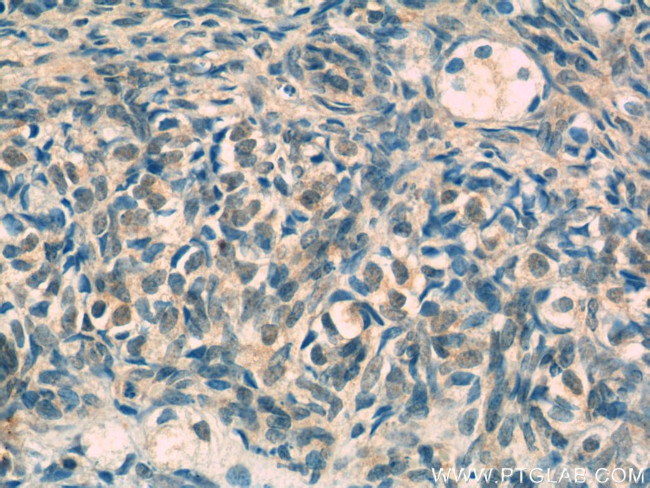 CROP Antibody in Immunohistochemistry (Paraffin) (IHC (P))