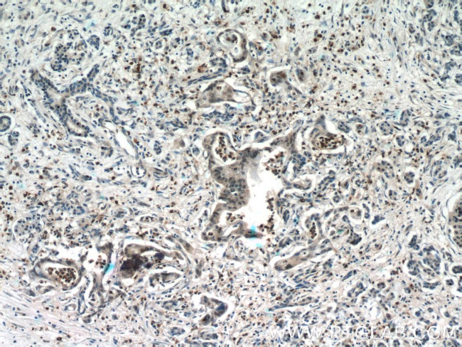 CROP Antibody in Immunohistochemistry (Paraffin) (IHC (P))