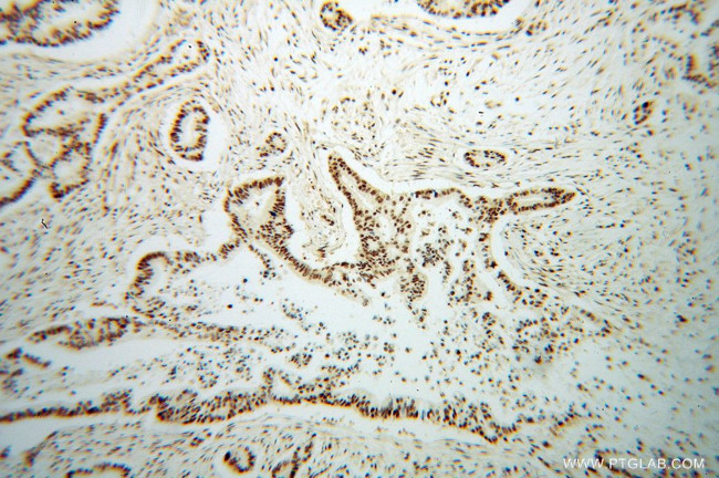 CROP Antibody in Immunohistochemistry (Paraffin) (IHC (P))