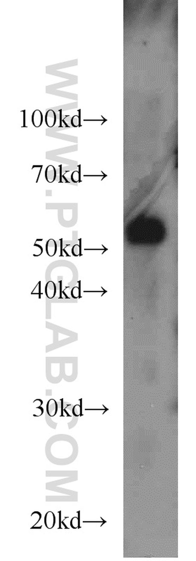 CROP Antibody in Western Blot (WB)