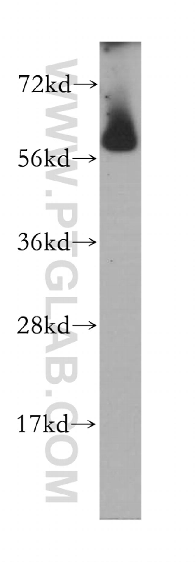 CROP Antibody in Western Blot (WB)