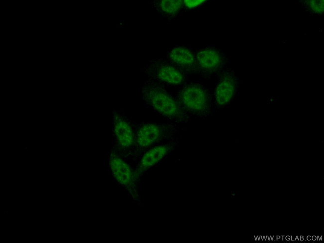 CROP Antibody in Immunocytochemistry (ICC/IF)