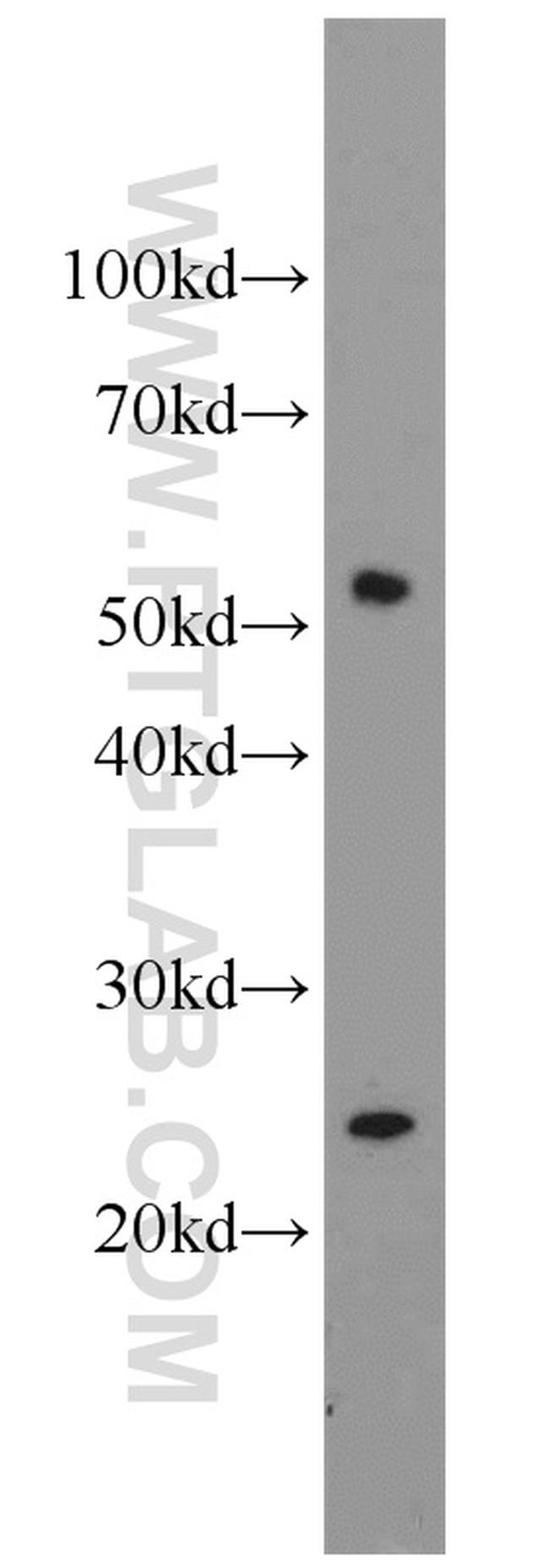 CROP Antibody in Western Blot (WB)