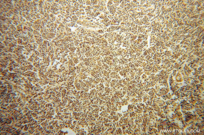 GRAP Antibody in Immunohistochemistry (Paraffin) (IHC (P))