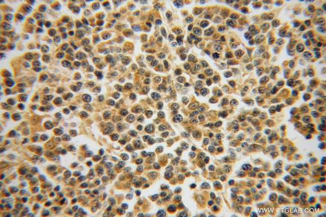 GRAP Antibody in Immunohistochemistry (Paraffin) (IHC (P))