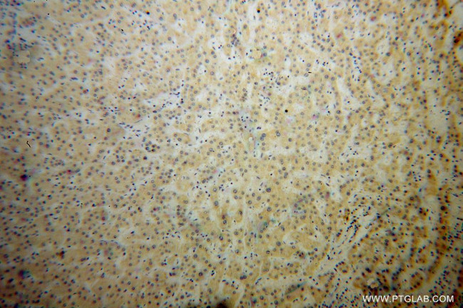 Synaptotagmin-1 Antibody in Immunohistochemistry (Paraffin) (IHC (P))