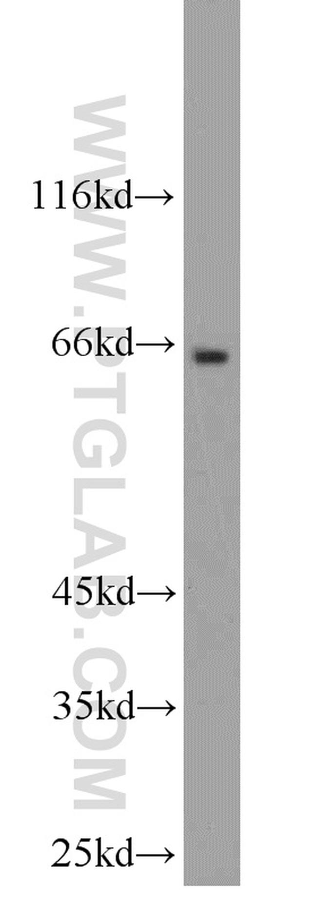 Synaptotagmin-1 Antibody in Western Blot (WB)