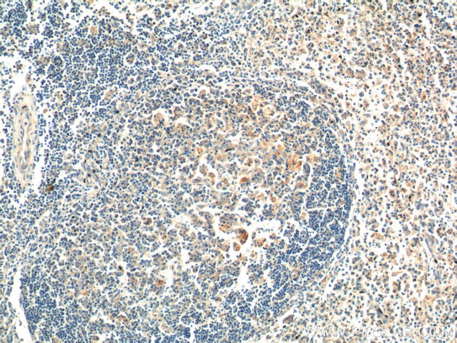 PSPH Antibody in Immunohistochemistry (Paraffin) (IHC (P))