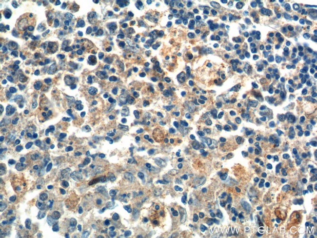 PSPH Antibody in Immunohistochemistry (Paraffin) (IHC (P))