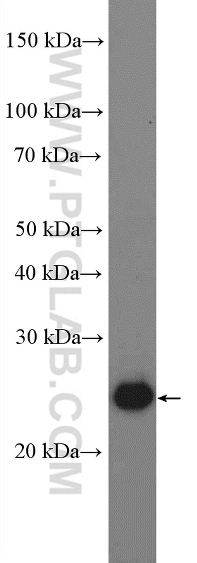 PSPH Antibody in Western Blot (WB)